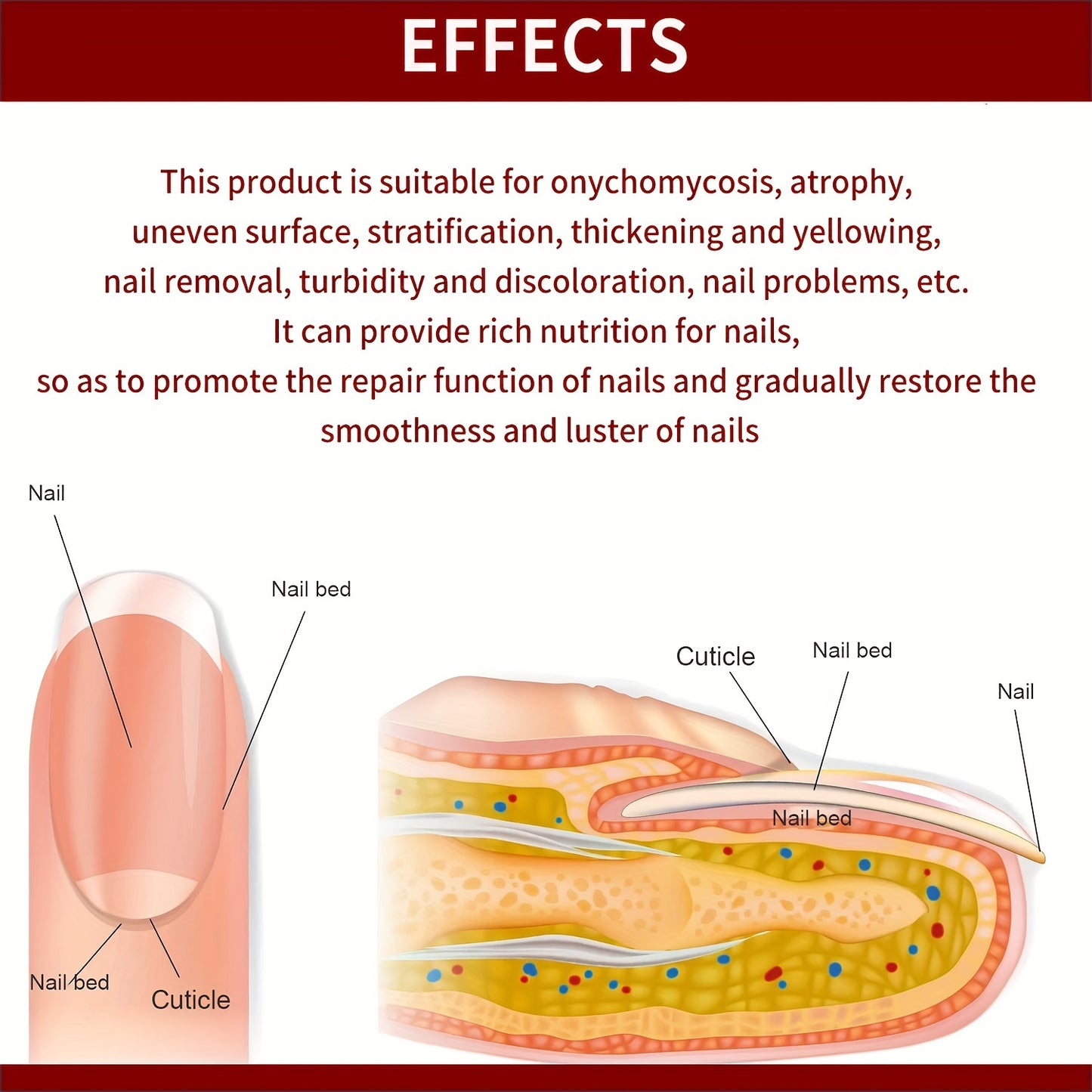 Líquido para tratamiento de hongos en las uñas de 0.68 oz - Fórmula 100% natural pura para uñas de los pies extrafuerte - Para uñas descoloridas, espesas, amarillas y con hongos - Solución antimicótica y hongos debajo de la uña - Uña con hongos